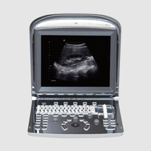 High-quality, advanced Ultrasound Machine designed for accurate and reliable diagnostic imaging in various medical settings. Our Ultrasound Machine provides enhanced image quality, improved diagnostic accuracy, and reduced examination time, making it a cost-effective medical solution for your needs.